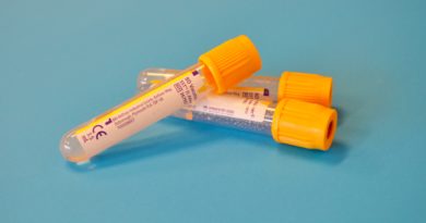 Fort Lauderdale Airport to open coronavirus testing site on December 9