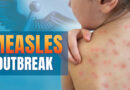 Prevention against measles