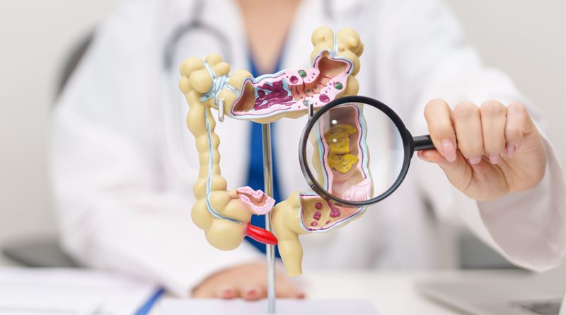 Salud del colon en tus 30 y 40 años: lo que debes saber